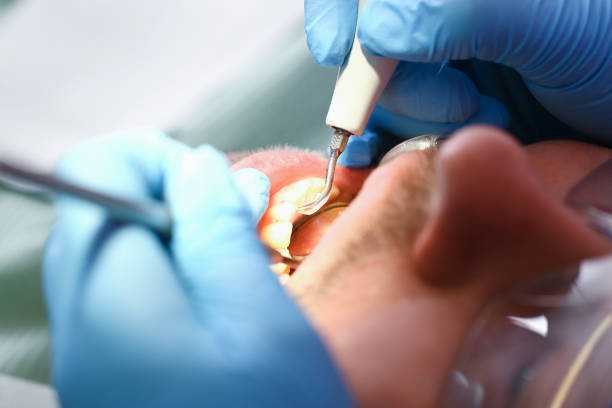 Best Emergency Dental Surgery in Turley, OK
